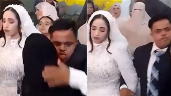 بعد واقعة عريس متلازمة داون.. أستاذ طب نفسي يوضح الحالات التي يمنع فيها الزواج 1 552 عريس بعد واقعة عريس متلازمة داون.. أستاذ طب نفسي يوضح الحالات التي يمنع فيها الزواج موقع في الجامعة